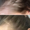 ¡ADICIONAL! CHAMPÚ EN BARRA DE JENGIBRE