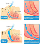 ¡AMPLÍA TU PEDIDO! CLIP MAGNETICO ANTIRONQUIDOS SLEEPYPAL